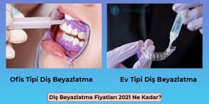 diş beyazlatma fiyatları