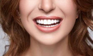 hollywood gülüşü fiyatları