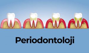 Periodontoloji