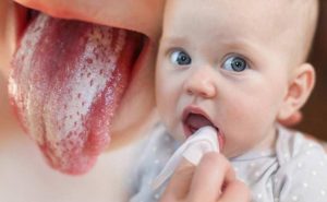 bebeklerde pamukçuk