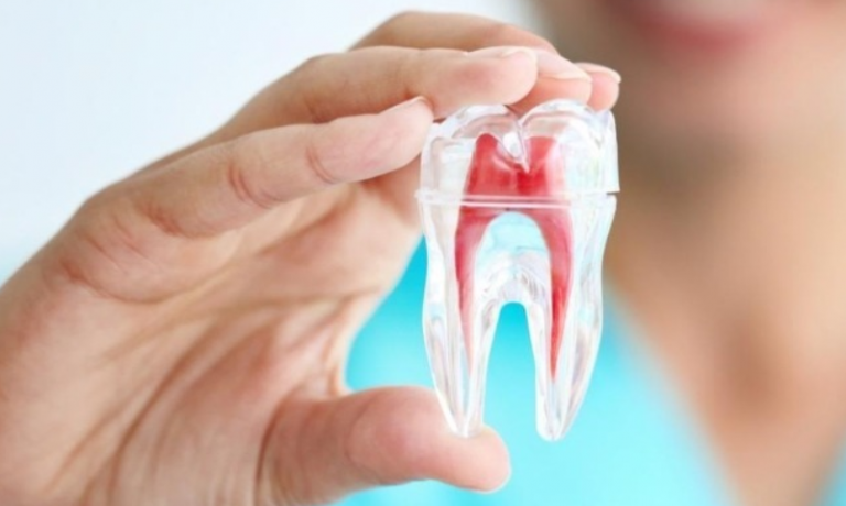 Diş kanal tedavisi Periodent