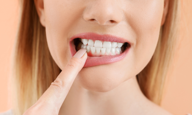 Diş Eti Hastalığı Nasıl Geçer?